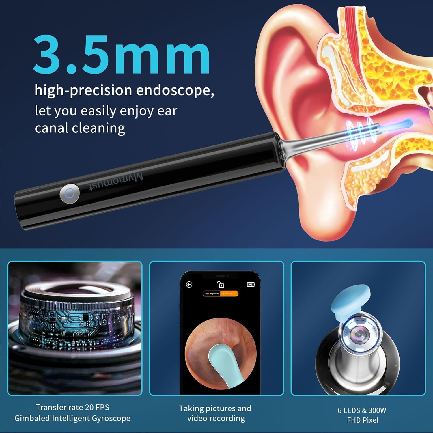 Mymomust Ear Wax Removal, Ear Cleaner with HD Ear Camera, Wireless Ear Otoscope Earwax Remover Kit with 4 Ear Pick & 6 LED Lights, Ear Cleaning Tool for iOS & Android, Black